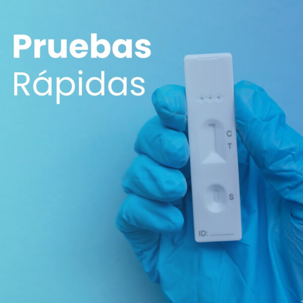 Pruebas rápidas